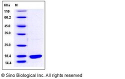 Sino Biological Recombinant Human Bcl-W Protein (His Tag), Quantity: Each