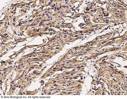 Sino Biological Anti-Cx3cr1 Antibody, Rabbit Polyclonal, Quantity: Each
