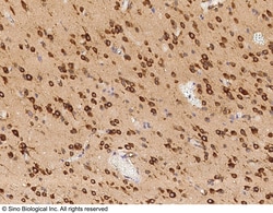 Sino Biological Anti-TLR2 Antibody, Mouse Monoclonal, Quantity: Each of
