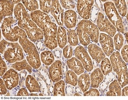 Sino Biological PUM2 Antibody, Rabbit PAb, Antigen Affinity Purified 100uL,