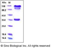 Sino Biological Human BACE1 / ASP2 Protein (Fc Tag) 100ug, Quantity: Each