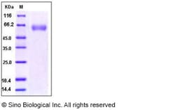 Sino Biological Recombinant Human BACE1 Protein (His Tag), HPLC-verified,
