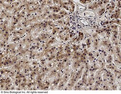 Sino Biological Anti-ALK-1 Antibody, Rabbit Polyclonal, Quantity: Each