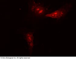 Sino Biological Anti-ATG12 Antibody, Rabbit Polyclonal, Quantity: Each