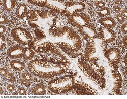 Sino Biological Anti-Cytokeratin 1/KRT1 Antibody, Rabbit Polyclonal, Quantity: