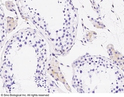 Sino Biological Anti-LY6K Antibody, Rabbit Polyclonal, Quantity: Each of