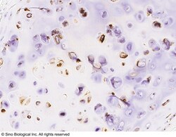 Sino Biological ACAN Antibody, Rabbit PAb, Antigen Affinity Purified 100uL,