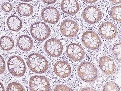 Sino Biological AGR2 Antibody, Rabbit PAb, Antigen Affinity Purified 100uL,