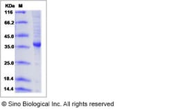 Sino Biological Recombinant Human AGRP Protein (hFc Tag), Quantity: Each