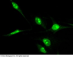 Sino Biological Anti-Nucleostemin Antibody, Rabbit Polyclonal, Quantity:
