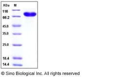 Sino Biological Recombinant Human CD14 Protein (hFc Tag), Quantity: Each