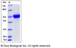 Sino Biological Recombinant Human CD14 Protein (His Tag), HPLC-verified,
