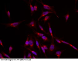 Sino Biological Anti-Glut4/SLC2A4 Antibody, Rabbit Polyclonal, Quantity: