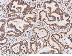 Sino Biological Anti-BMPR1A/ALK-3 Antibody, Rabbit Polyclonal, Quantity: