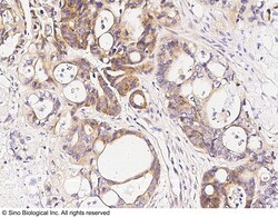 Sino Biological Anti-CAMKIV Antibody, Rabbit Polyclonal, Quantity: Each