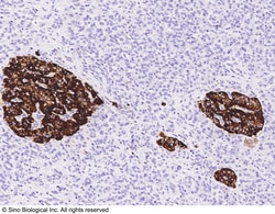 Sino Biological Anti-Chromogranin A/CHGA Antibody, Rabbit Polyclonal, Quantity: