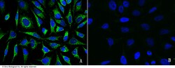 Sino Biological GOT2 Antibody, Rabbit PAb, Antigen Affinity Purified 100uL,