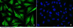 Sino Biological Anti-CBP/CREBBP Antibody, Rabbit Polyclonal, Quantity: