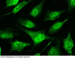 Sino Biological Anti-BAX Antibody, Rabbit Polyclonal, Quantity: Each of