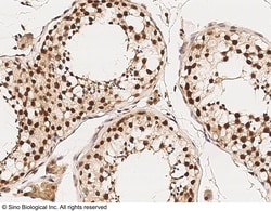 Sino Biological Anti-HDAC11 Antibody, Rabbit Polyclonal, Quantity: Each