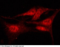 Sino Biological Anti-HDAC4 Antibody, Rabbit Polyclonal, Quantity: Each