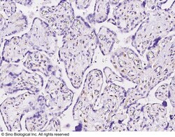 Sino Biological Anti-CDK2 Antibody, Rabbit Polyclonal, Quantity: Each of