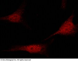 Sino Biological PRMT1 Antibody, Rabbit PAb, Antigen Affinity Purified 100uL,