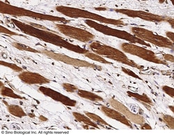 Sino Biological Anti-p38 Antibody, Rabbit Polyclonal, Quantity: Each of