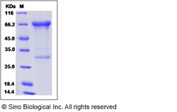 Sino Biological Human MMP-2 / CLG4A Protein 20ug, Quantity: Each of 1