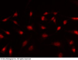 Sino Biological Anti-BCOR Antibody, Rabbit Polyclonal, Quantity: Each of