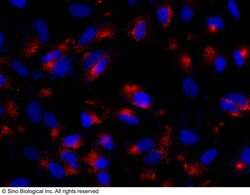 Sino Biological ADA / Adenosine deaminase Antibody, Rabbit PAb, Antigen