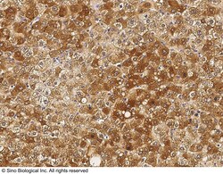 Sino Biological Angiogenin / RNASE5 Antibody, Rabbit PAb, Antigen Affinity