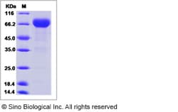 Sino Biological Recombinant Human PD-L1/B7-H1 Protein (ECD, mFc Tag), HPLC-verified,