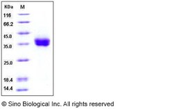 Sino Biological Human PD-L1 / B7-H1 / CD274 Protein (His Tag) 100ug, Quantity: