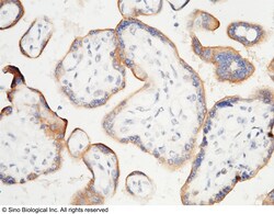 Sino Biological Recombinant Anti-PD-L1/B7-H1 Antibody, Rabbit Monoclonal,