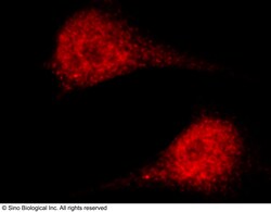 Sino Biological Anti-ASF1A Antibody, Rabbit Polyclonal, Quantity: Each