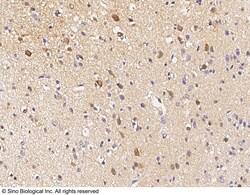 Sino Biological CAMK2A Antibody, Rabbit PAb, Antigen Affinity Purified