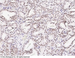 Sino Biological Anti-CREB Antibody, Rabbit Polyclonal, Quantity: Each of