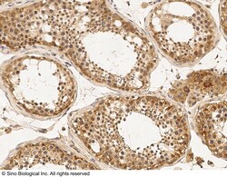 Sino Biological Anti-Argonaute 4/Ago4 Antibody, Rabbit Polyclonal, Quantity:
