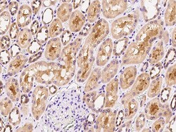 Sino Biological Anti-FGF5 Antibody, Rabbit Polyclonal, Quantity: Each of