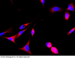 Sino Biological GAS2 / growth arrest-specific 2 Antibody, Rabbit PAb, Antigen