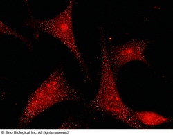 Sino Biological GSTP1 Antibody, Rabbit PAb, Antigen Affinity Purified 100uL,