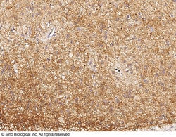Sino Biological Anti-DPM1 Antibody, Rabbit Polyclonal, Quantity: Each of