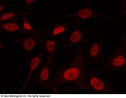 Sino Biological Anti-KAT1/HAT1 Antibody, Rabbit Polyclonal, Quantity: Each