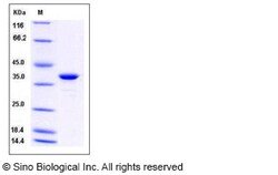Sino Biological Recombinant Human GAPDH Protein (His Tag), Quantity: Each