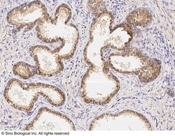 Sino Biological Claudin 3 Antibody, Rabbit PAb, Antigen Affinity Purified