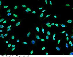Sino Biological Anti-MEK5/MAP2K5 Antibody, Rabbit Polyclonal, Quantity: