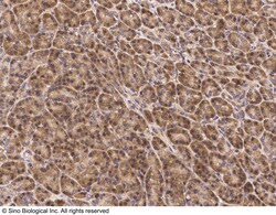 Sino Biological Anti-JNK2 Antibody, Rabbit Polyclonal, Quantity: Each of