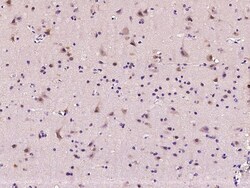 Sino Biological MAP1 Antibody, Rabbit PAb, Antigen Affinity Purified 100uL,