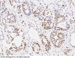 Sino Biological Recombinant Anti-MSH6 Antibody, Rabbit Monoclonal, Quantity: